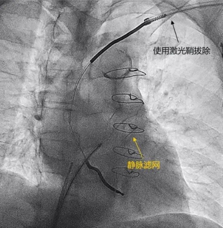 from clipboard from clipboard